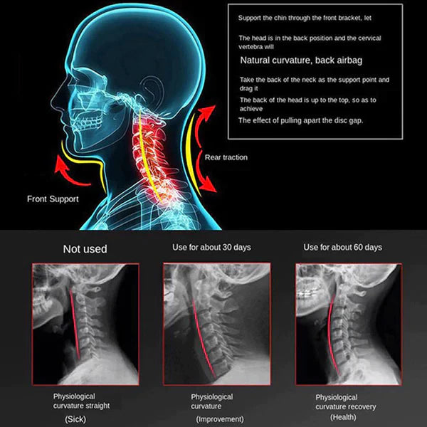 "Orthopaedic cervical collar brace for neck pain relief, ergonomic design, adjustable, breathable fabric, personal fit"