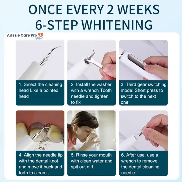 "Ultrasonic dental plaque remover with metal tips, ergonomic cordless design, USB rechargeable for effective tartar removal."