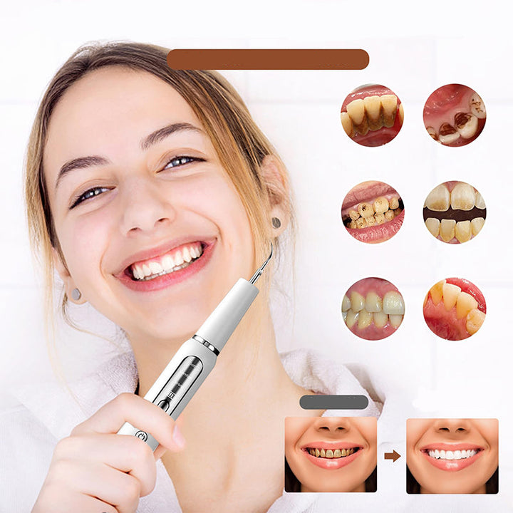 "Ultrasonic dental plaque remover with metal tips, ergonomic cordless design, USB rechargeable for effective tartar removal."