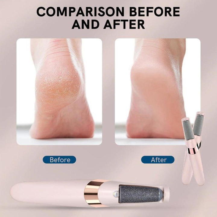 "Women's pink electric foot file with high-speed motor, designed for removing calluses and smoothing feet effectively."