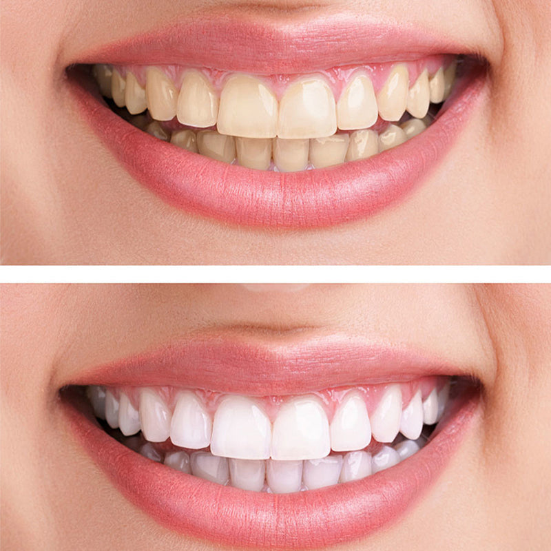 Close-up of Advanced Hydroxyapatite Whitening Toothpaste, for fresh breath and cavity protection