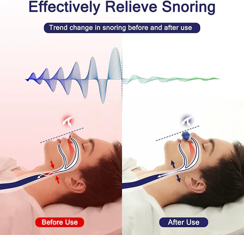 Advanced maskless nasal CPAP for effective sleep apnea & anti-snoring treatment. Lightweight & easy to use.