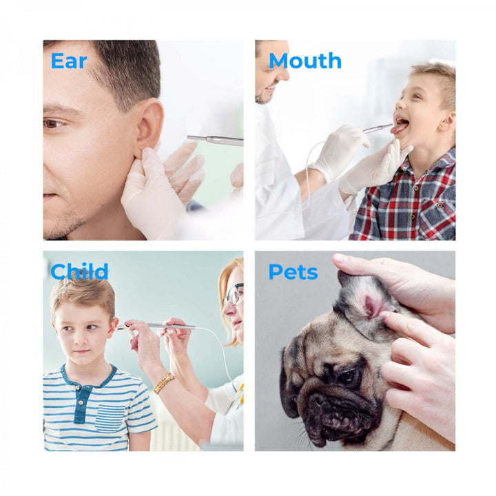 Rechargeable digital otoscope with 4.5-inch display. Essential ear camera for home ear health & ear wax inspection.
