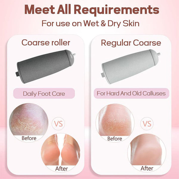 Electric pedicure device illustrating easy-to-clean design, essential for foot hygiene