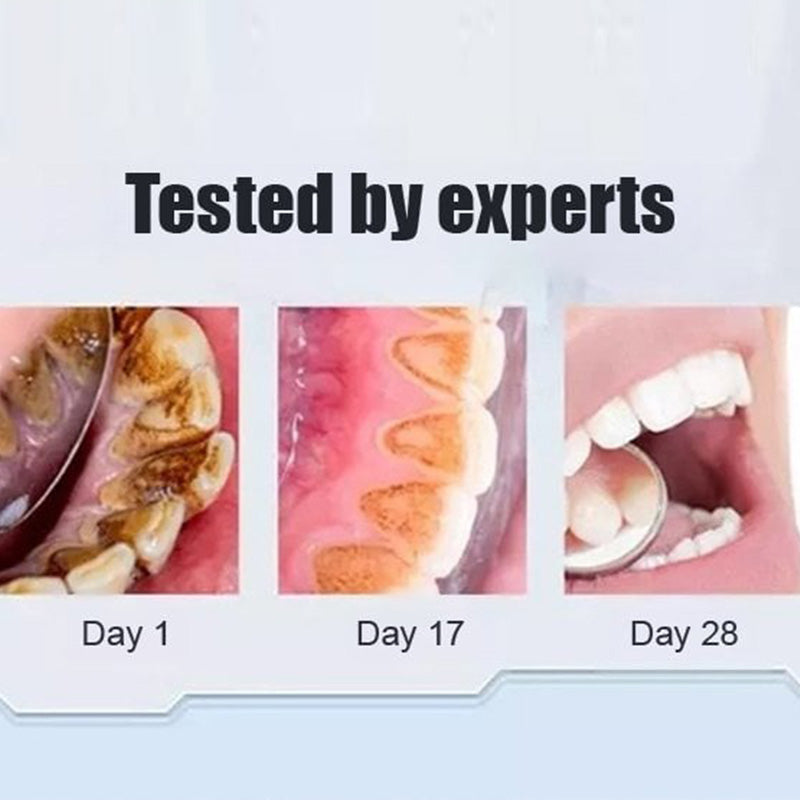 Oral care set featuring probiotic whitening toothpaste, promoting fresh breath and healthy gums.
