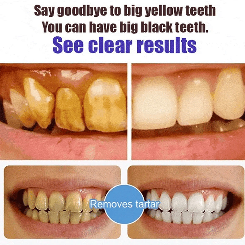 Probiotic toothpaste tube held by a hand, suggesting daily use for oral health benefits.