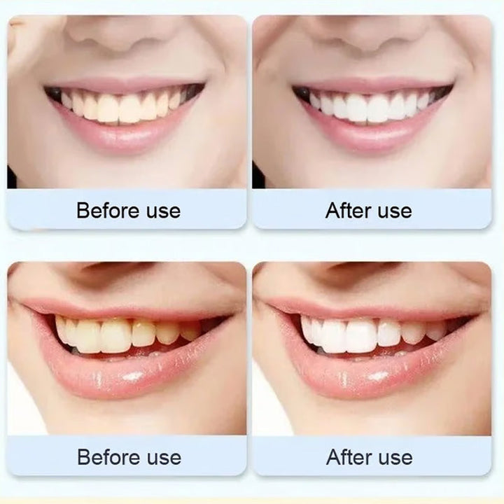 Whitening probiotic toothpaste gel, displaying its smooth texture for effective dental cleaning.