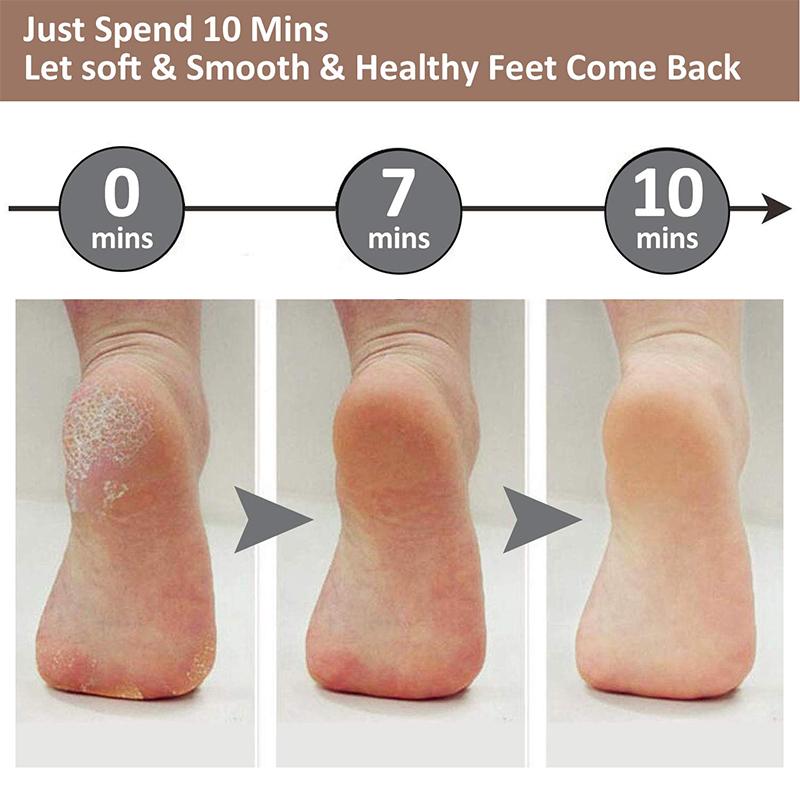 Skin care innovation: Foot file and callus remover, delivering smooth, soft feet through exfoliation.