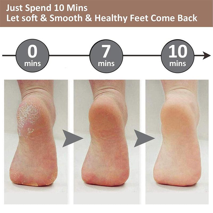Skin care innovation: Foot file and callus remover, delivering smooth, soft feet through exfoliation.