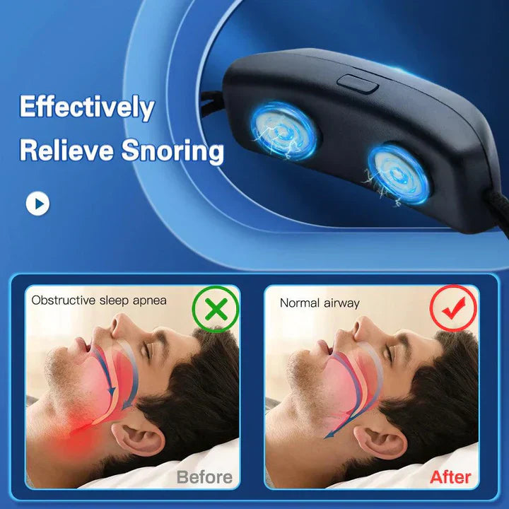Effective anti-snore solution device for undisturbed sleep. Combat snoring and enjoy peaceful nights.