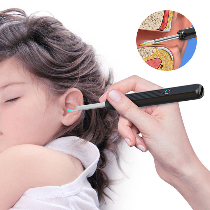 Ergonomic smart visual ear cleaner with HD camera, designed for comfortable and effective wax removal.