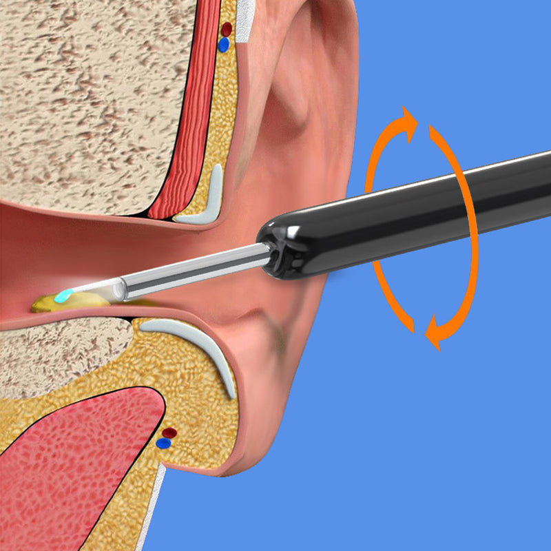 High-tech smart ear cleaner with HD camera, providing a clear view for thorough ear wax removal.