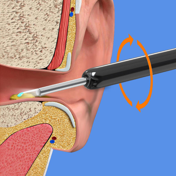 High-tech smart ear cleaner with HD camera, providing a clear view for thorough ear wax removal.