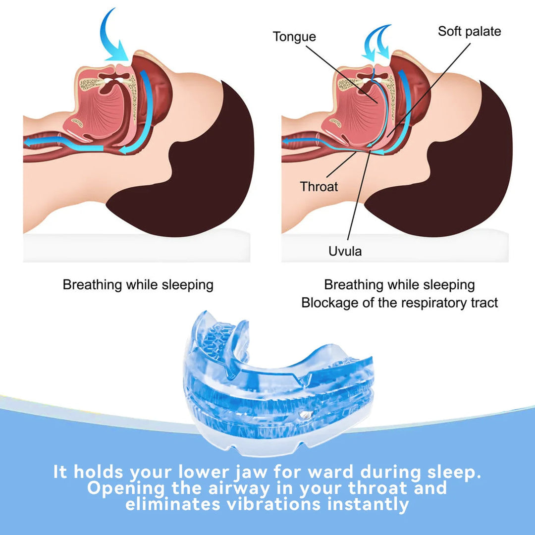 BPA-free anti-snore dental guard, a custom fit mouth guard for men & women seeking snoring relief and better sleep.
