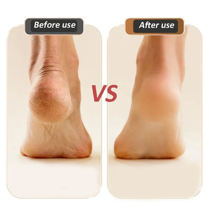 Unisex Electric Foot Callus Remover in action, demonstrating its easy and safe operation.