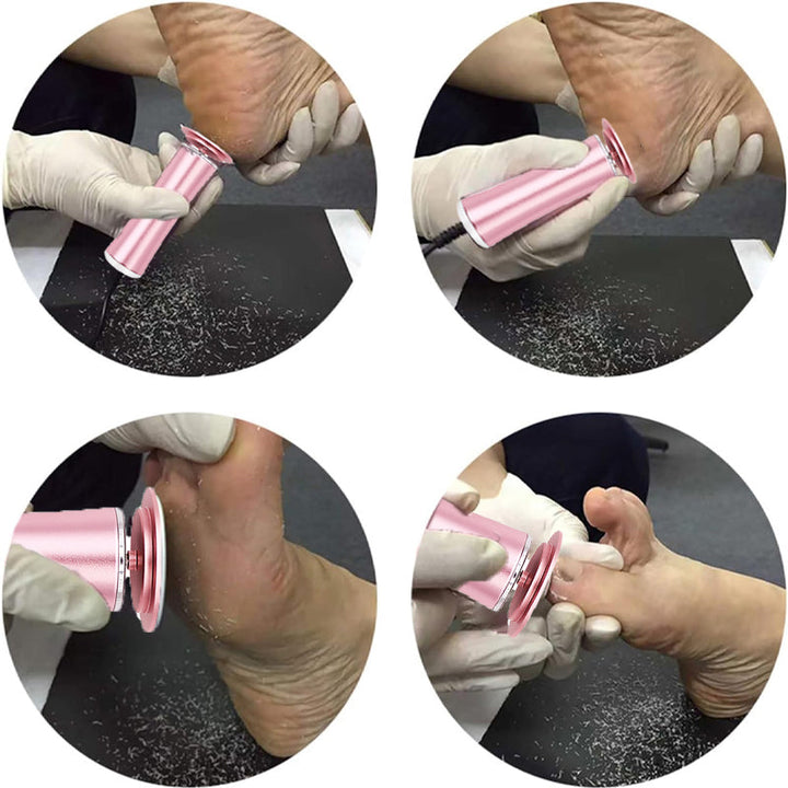 Person's feet before and after using the electric foot callus remover, showcasing dramatic results