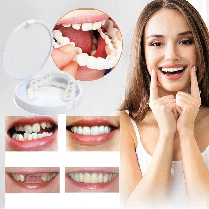 Unisex snap-on veneers for instant, natural-looking smile transformation & confidence boost.