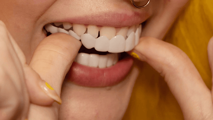 Achieve an instant, natural smile transformation with these unisex snap-on veneers.