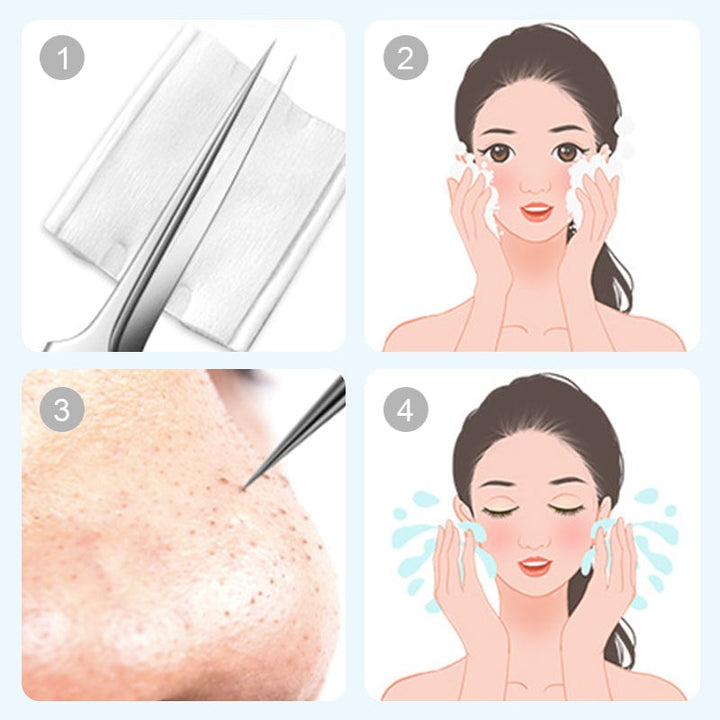 High-quality stainless steel pimple remover set, anti-slip handle for safe use on face